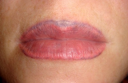 Губы выходят за контур. Перманент губ. Неудачный контур перманентного макияжа губ.